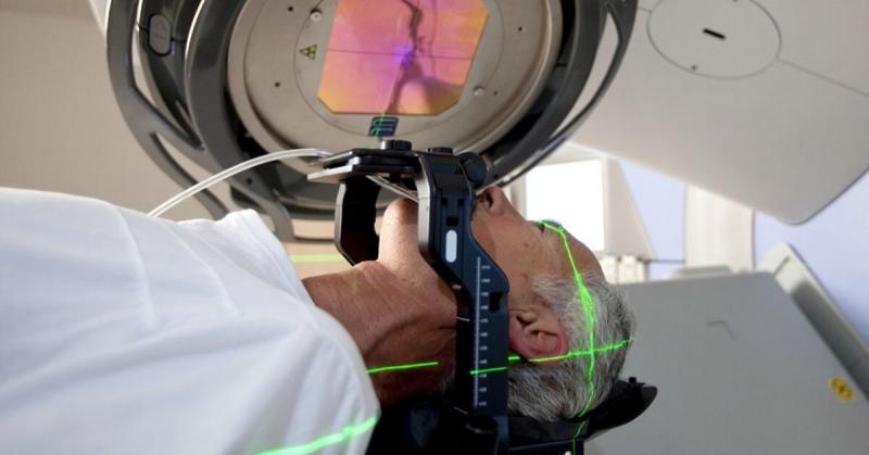 RADIOCIRURGIA: Uma moderna técnica Neurocirúrgica